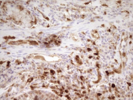IHC-plus™ LGALS9 / Galectin 9 Antibody (clone 2A4)
