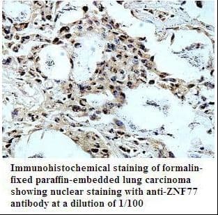 Polyclonal Rabbit anti-Human ZNF77 Antibody (aa5-258, IHC, WB)