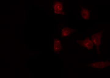 Polyclonal Rabbit anti-Human PGIS / PTGIS Antibody (IF, WB)