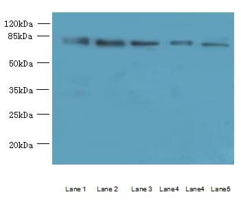 Polyclonal Rabbit anti-Human ACSBG2 Antibody (IHC, WB)