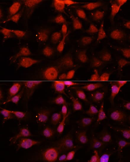 IHC-plus™ Polyclonal Rabbit anti-Human CD34 Antibody (IHC, IF, WB)