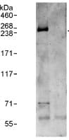 Capicua / CIC Antibody (aa1500-1608, DY650)