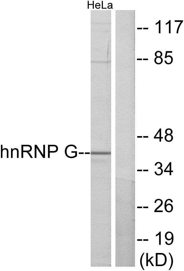 Polyclonal Rabbit anti-Human RBMX Antibody (IF, WB)