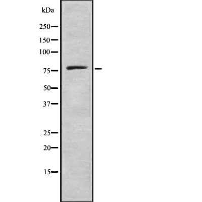 Polyclonal Rabbit anti-Human ADGRL4 / ELTD1 Antibody (IHC, WB)