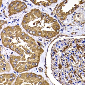 Trimethylguanosine Synthase 1 Antibody
