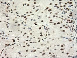 PRKCE / PKC-Epsilon Antibody (clone OTI4B3, Carrier-free)
