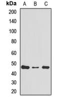 RPL4 / Ribosomal Protein L4 Antibody