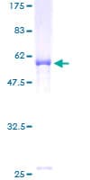 Human ELMOD2 Protein (Recombinant GST)