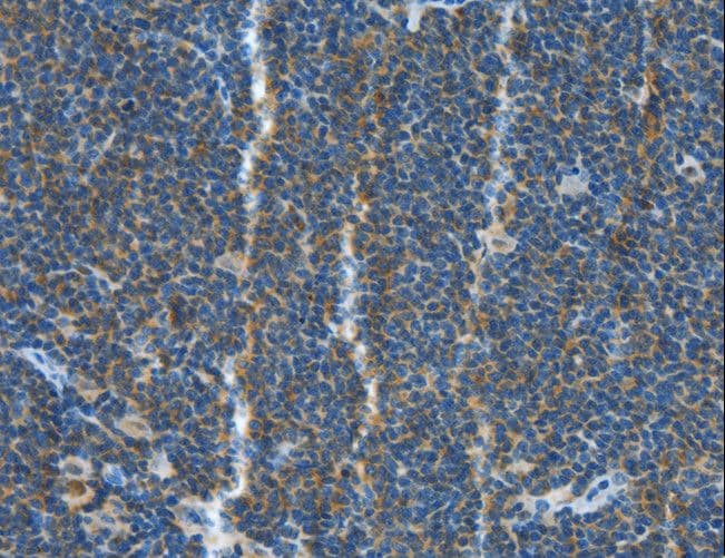 BAFF / TNFSF13B Antibody