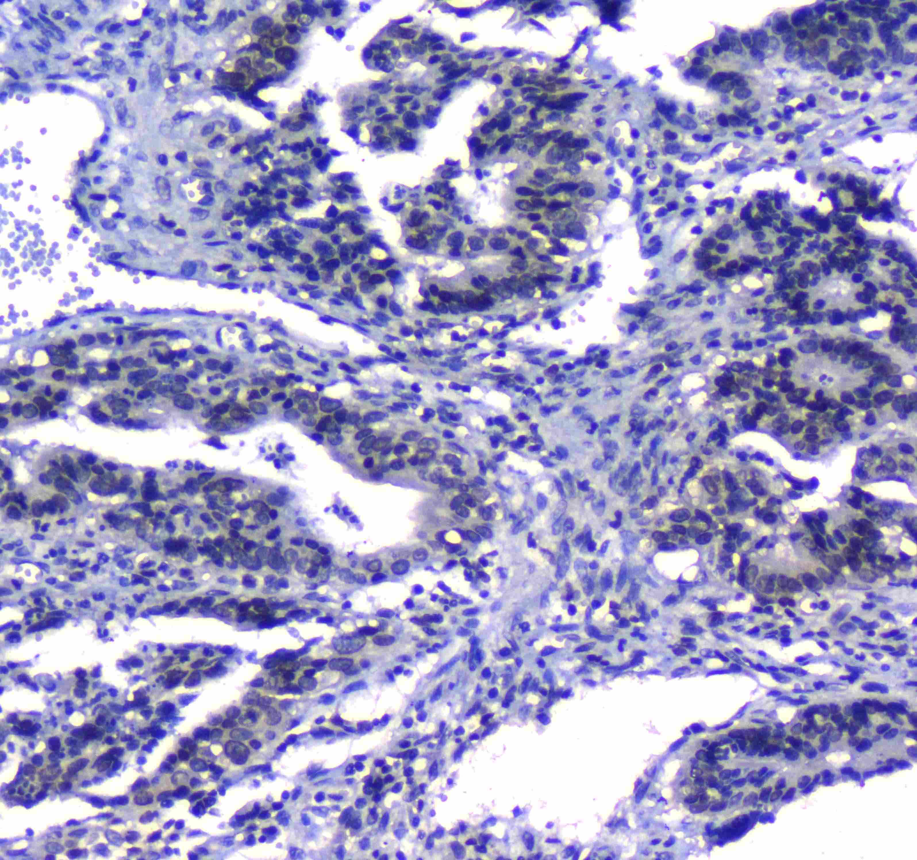 MAX Antibody