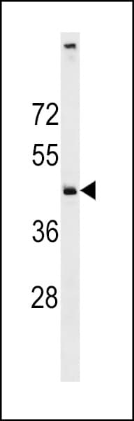 DM4E3 / C11orf24 Antibody (aa63-92)