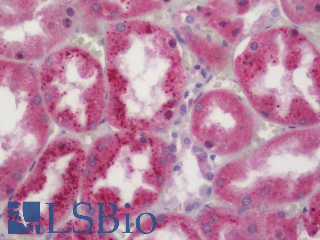 IHC-plus™ MRPL34 Antibody (aa21-70)