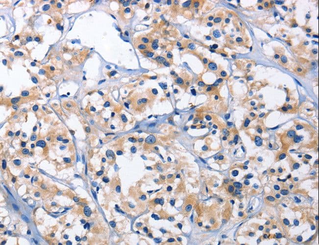 CAPZA2 / CAPZ Alpha 2 Antibody