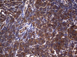 Monoclonal Mouse anti-Human PIK3C2A Antibody (clone OTI15H1, aa230-560, IHC, WB)