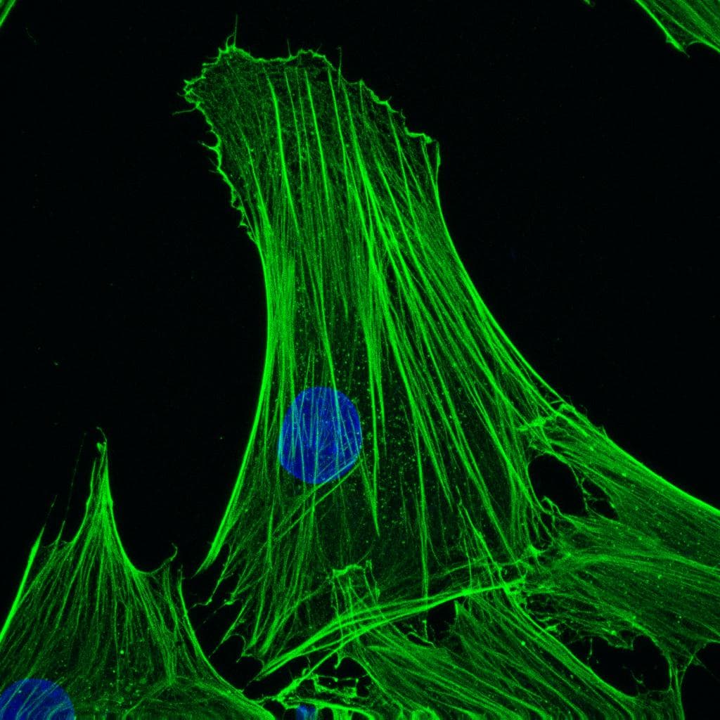 IHC-plus™ ACTB / Beta Actin Antibody (clone 4C2)