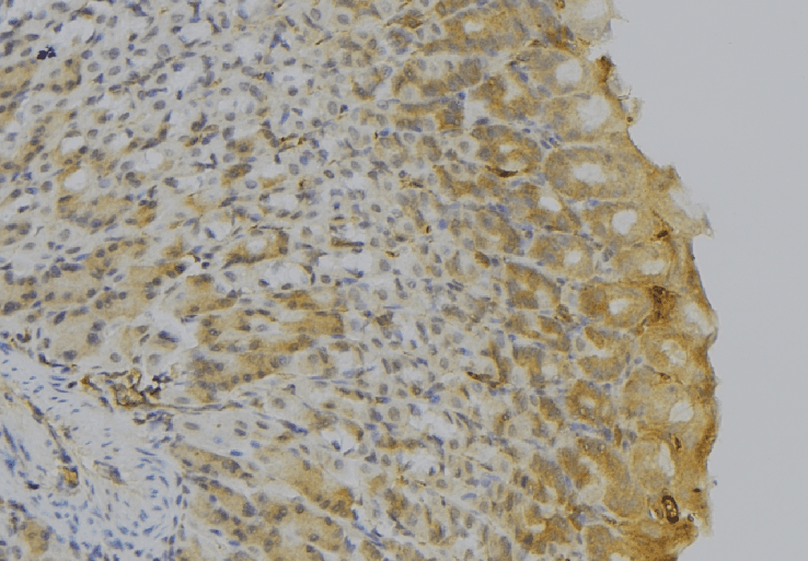 HLA-DQA1 Antibody