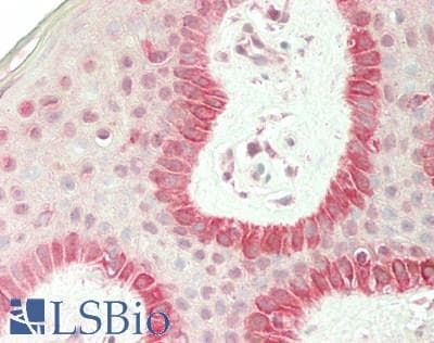 IHC-plus™ Polyclonal Rabbit anti-Human FZD6 / Frizzled 6 Antibody (aa108-157, IHC, WB)
