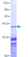 Human PAWR / PAR4 Protein (Recombinant GST, N-terminus)