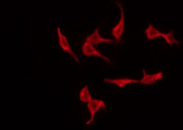 Polyclonal Rabbit anti-Human TP53 / p53 Antibody (phospho-Ser315, IHC, IF, WB)