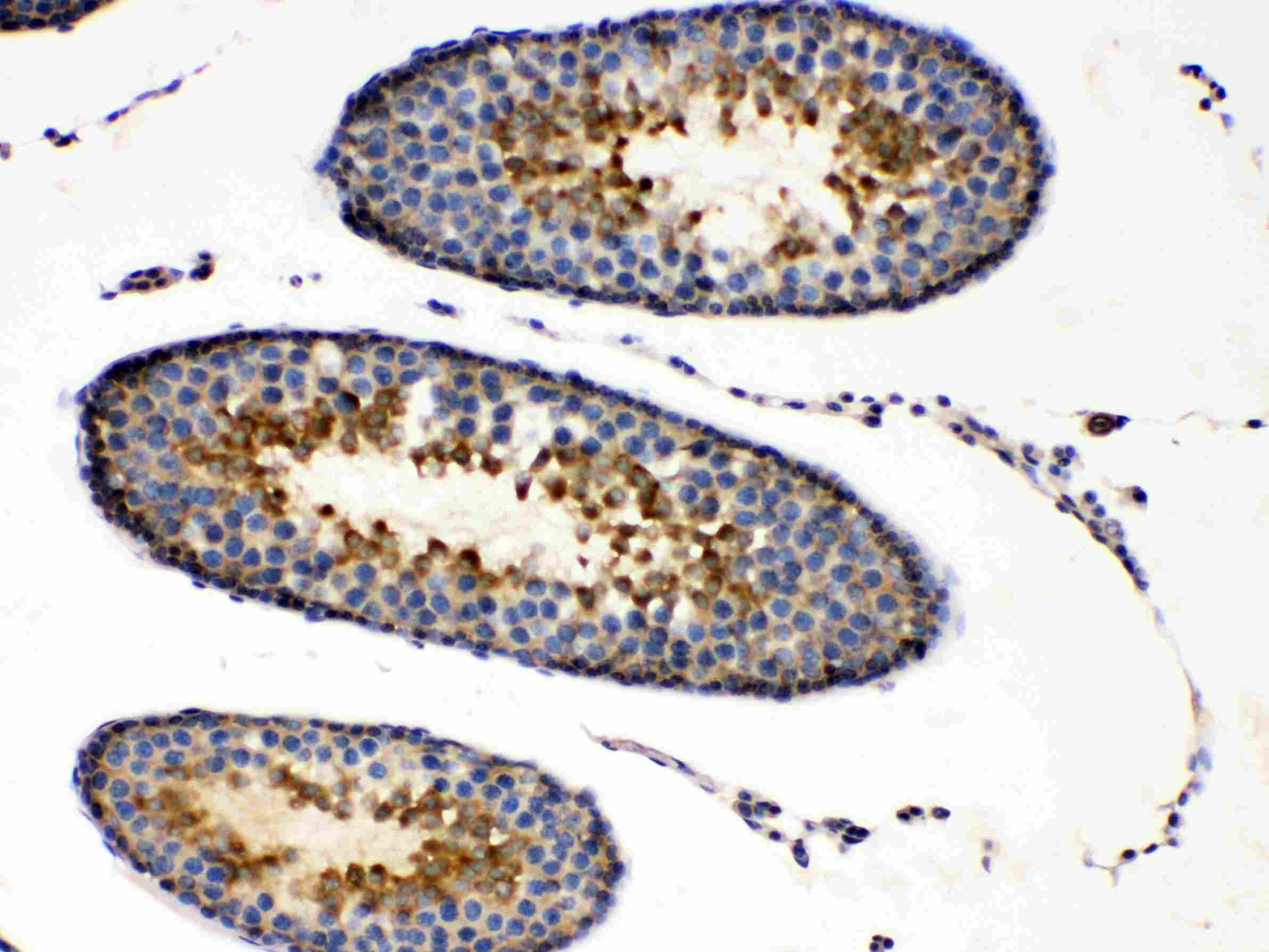 PRKAR1A Antibody