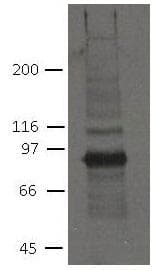 PKP2 / Plakophilin 2 Antibody (clone 8H6)