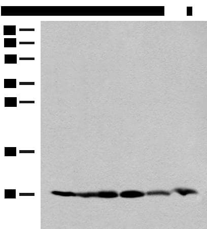 RPS28 / Ribosomal Protein S28 Antibody