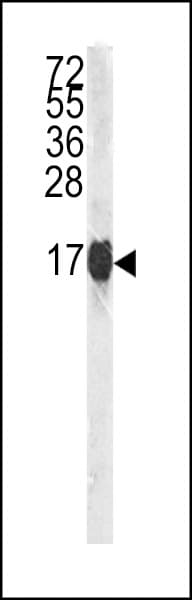 Polyclonal Rabbit anti-Human Histone H3 Antibody (Ser10, WB)