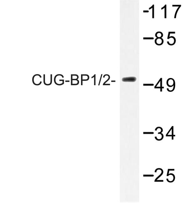 Polyclonal Rabbit anti-Human CUGBP1/2 Antibody (Lys95, IHC, WB)