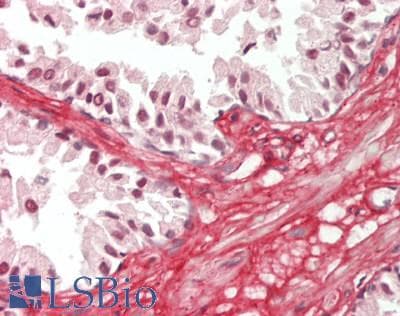 COL6A3 / Collagen VI Alpha 3 Antibody (aa463-624)