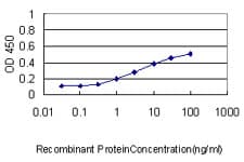 WC1 / ATP7B Antibody (clone 3E10)