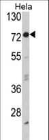 Polyclonal Rabbit anti-Human EIF2AK1 Antibody (aa267-296, IHC, WB)