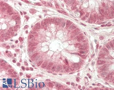 IHC-plus™ TATDN3 Antibody