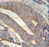 Polyclonal Rabbit anti-Human DACT1 / DAPPER Antibody (aa13-41, IHC, WB)
