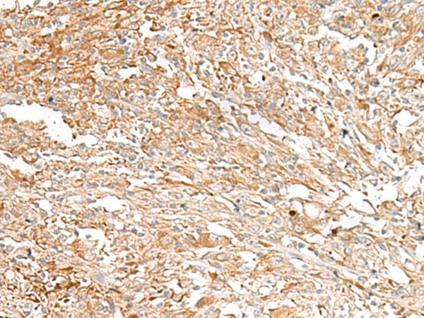Polyclonal Rabbit anti-Human IBSP / Bone Sialoprotein Antibody (IHC, WB)
