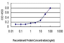 IHC-plus™ GNAI1 / Gi Antibody (clone 2B8-2A5)