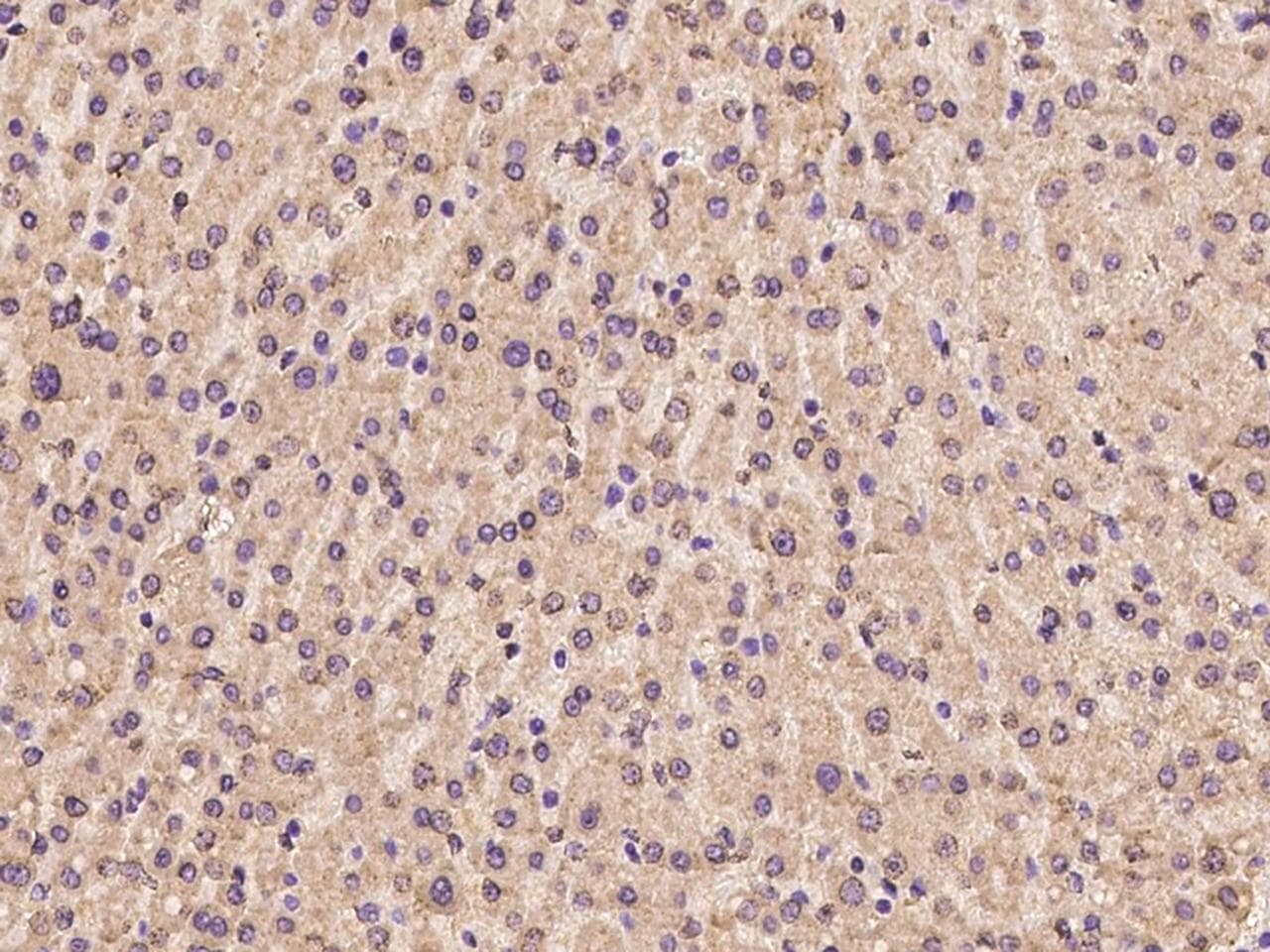 Polyclonal Rabbit anti-Human CREB3L2 / BBF2H7 Antibody (IHC)