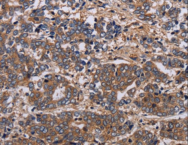 HTR2B / 5-HT2B Receptor Antibody