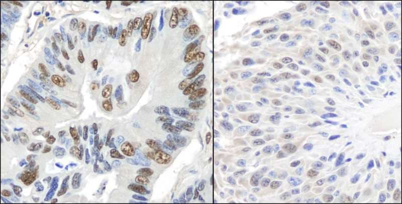 Polyclonal Rabbit anti-Human GAPDH Antibody (aa150-200, IHC, WB)