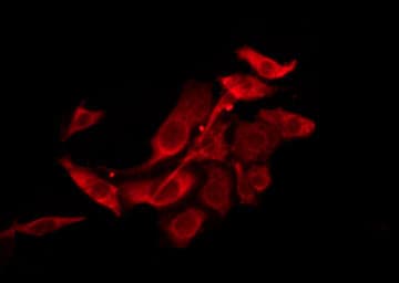 Polyclonal Rabbit anti-Human TAS2R39 Antibody (IF, WB)