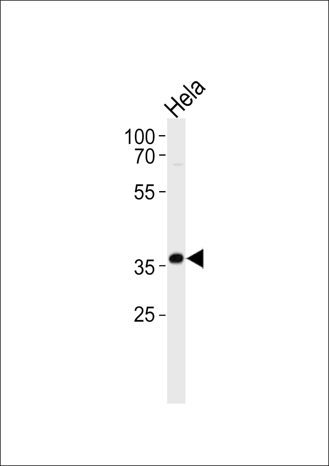 DDX / AKR1C3 Antibody (aa107-135)