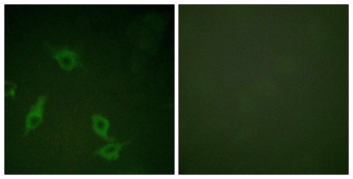 FAK / Focal Adhesion Kinase Antibody (p397)