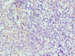 IRF4 Antibody (aa180-451)