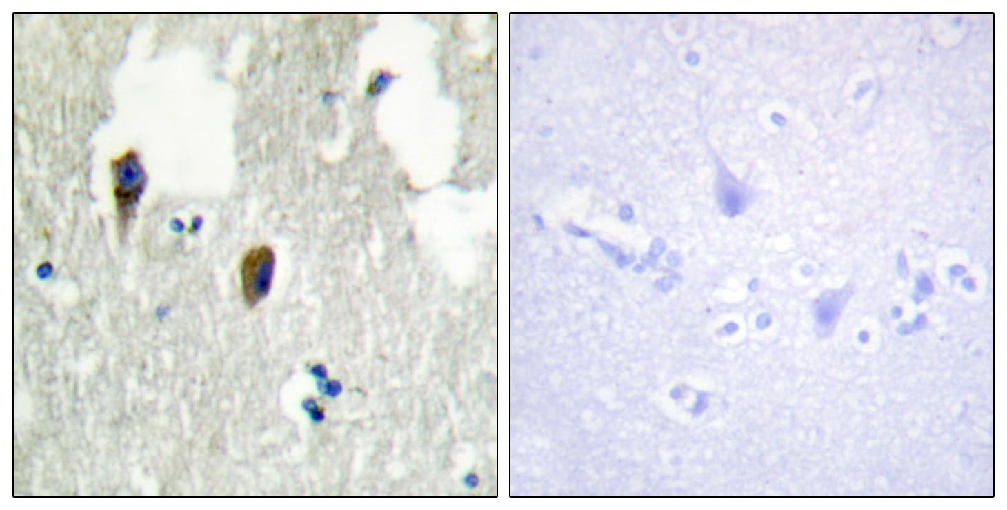 KLHL3 Antibody (aa10-59)