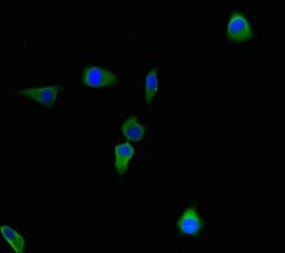 Polyclonal Rabbit anti-Human CBWD2 Antibody