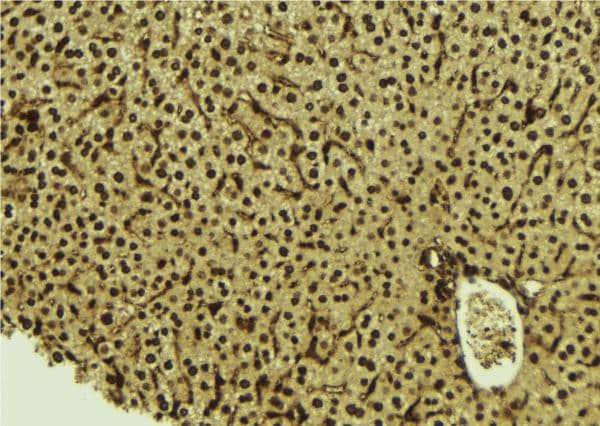 HDGF Antibody