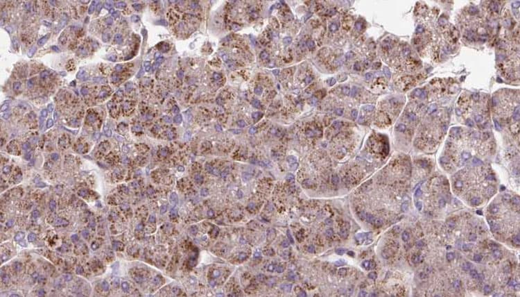 Polyclonal Rabbit anti-Human PDHX / Protein X / ProX Antibody (IHC, WB)