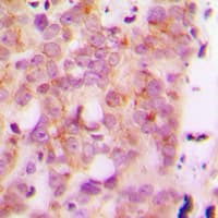 HLA-H Antibody (Internal)