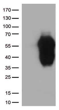 Monoclonal Mouse anti-Human HAVCR2 / TIM-3 Antibody (clone OTI2E5, WB)