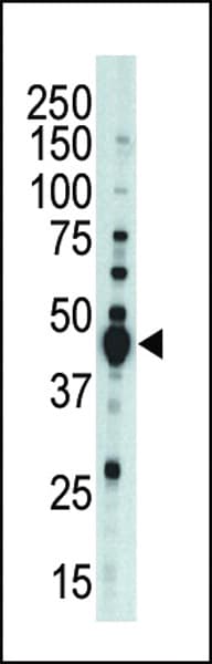 Polyclonal Rabbit anti-Human AURKB / Aurora-B Antibody (aa6-35, IHC, WB)