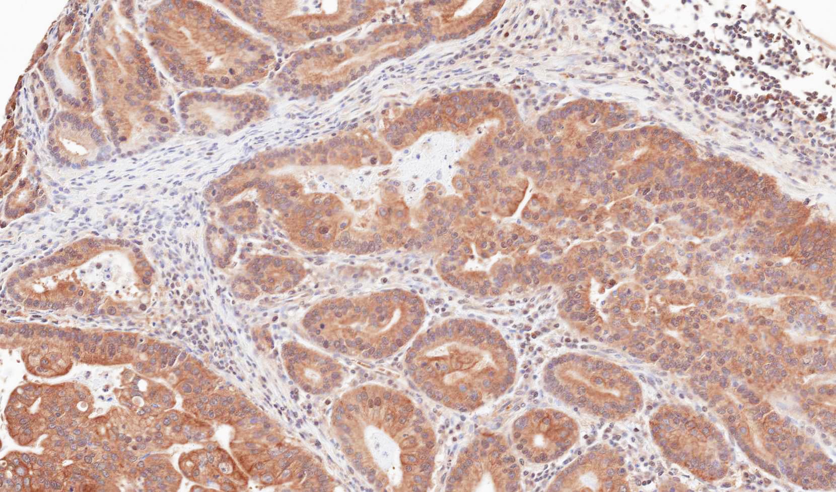 TRIM23 Antibody (aa1-44)